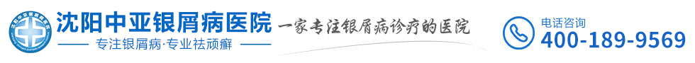 沈陽(yáng)皇姑銀康皮膚病門診部_遼寧沈陽(yáng)銀屑病醫(yī)院排行榜-沈陽(yáng)中亞銀屑病醫(yī)院