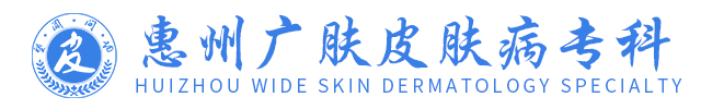 問答_普通文章_惠州治療皮膚病哪家好-惠州廣膚皮膚專科「掛號」惠州皮膚病醫院