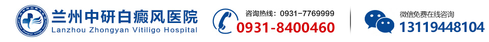 蘭州看白癜風的專科醫院-蘭州有幾家白癜風專科醫院-蘭州治療白斑專科的好醫院